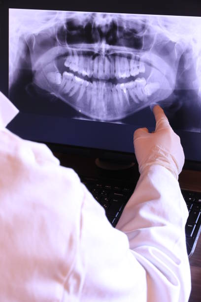 Best Emergency TMJ Treatment in Cairo, IL